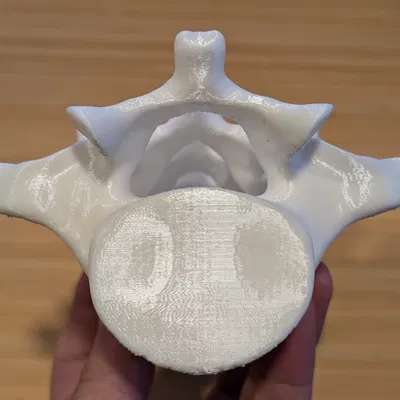 Đốt sống thắt lưng (Lumbar vertebrae)