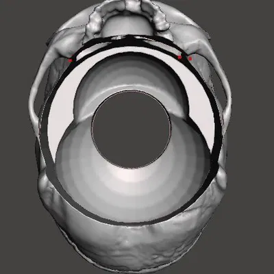 Bottle Skull – Ốp sọ trang trí cho chai