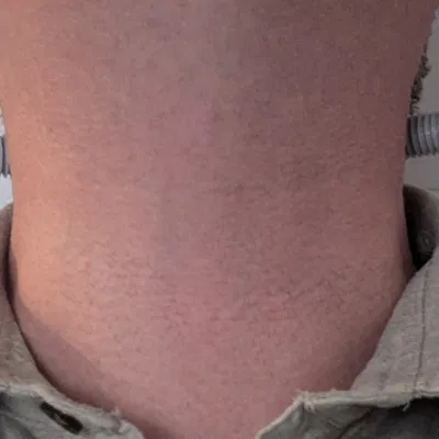 Phụ Kiện Bu-lông Cổ Frankenstein Cho Trang Phục Halloween