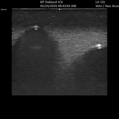 Mô hình thực hành tiếp cận mạch máu dưới hướng dẫn siêu âm