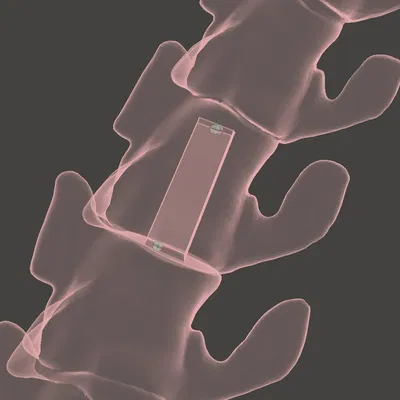 Mô hình T-rex 200% - Đã sửa lỗi, tối ưu support và nâng cấp hộp sọ