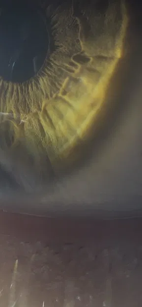 Case Modular CMF Phone 2 Pro Kèm Phụ Kiện Kính Hiển Vi - Image 6