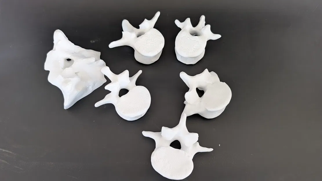 Mô hình tập huấn nội soi cột sống thắt lưng (Lumbar Endoscopy Training Simulator) - Image 4