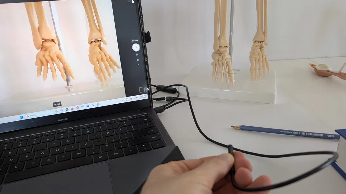 Camera Tập Nội Soi Cột Sống - Image 6