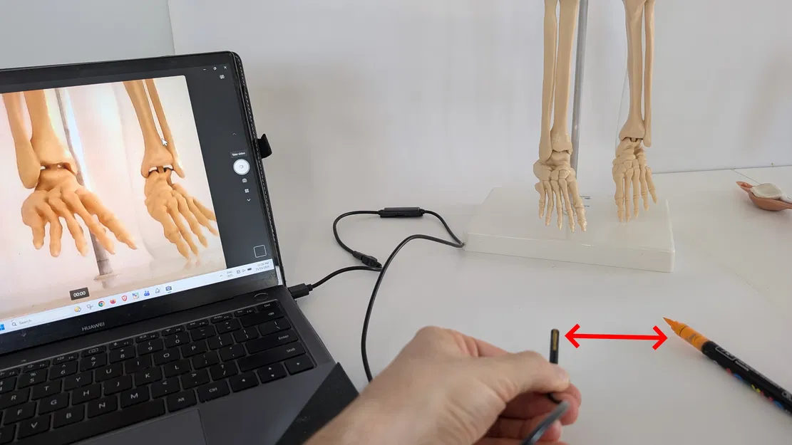 Camera Tập Nội Soi Cột Sống - Image 7