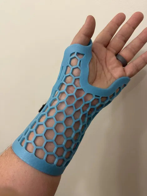 Nẹp Cổ Tay (Tự Điều Chỉnh Theo Hình Dáng) - Image 1