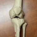 Mô hình giải phẫu khớp gối người (xương đùi, xương bánh chè, xương chày và xương mác) - Thumbnail 1