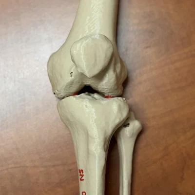 Mô hình giải phẫu khớp gối người (xương đùi, xương bánh chè, xương chày và xương mác)