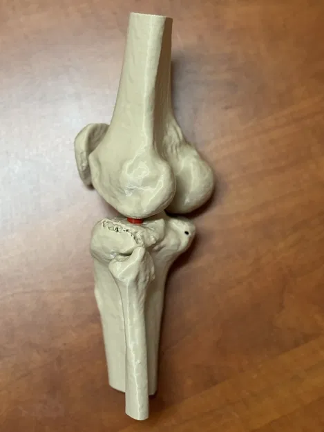 Mô hình giải phẫu khớp gối người (xương đùi, xương bánh chè, xương chày và xương mác) - Image 2