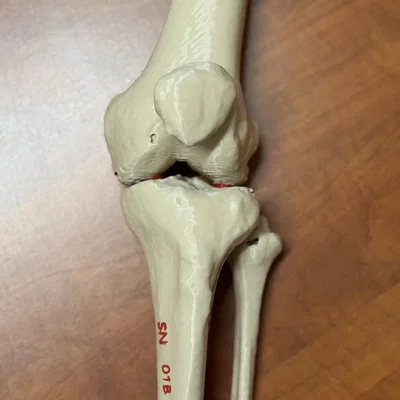 Mô hình giải phẫu khớp gối người (xương đùi, xương bánh chè, xương chày và xương mác)