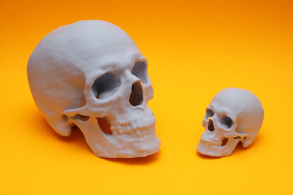 Mô hình hộp sọ từ dữ liệu quét CT - Image 3