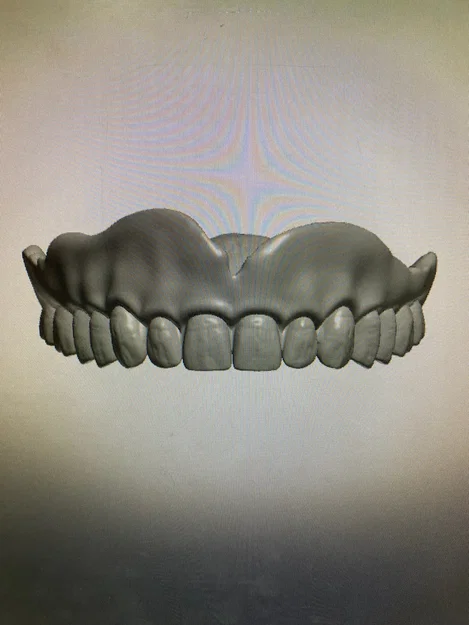 Mô hình hàm răng giả trên và dưới dùng làm đạo cụ - Image 1