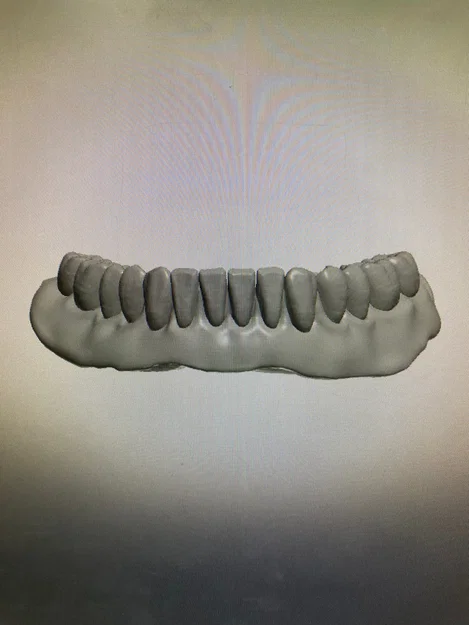 Mô hình hàm răng giả trên và dưới dùng làm đạo cụ - Image 2