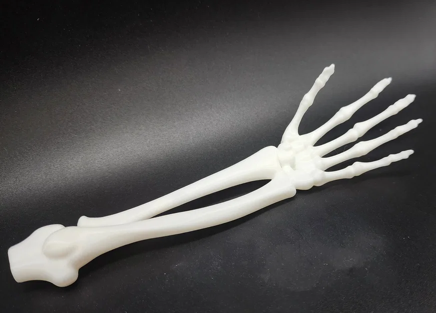 Cánh tay và bàn tay xương xẩu (Skeletal Forearm & Hand) - Image 4
