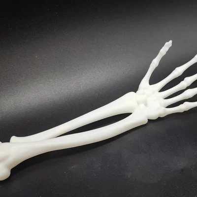 Cánh tay và bàn tay xương xẩu (Skeletal Forearm & Hand)