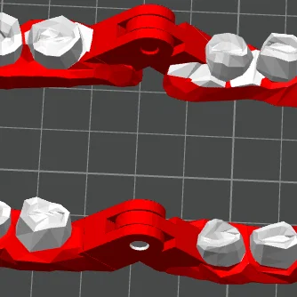 Mô hình hàm răng 3D cử động linh hoạt - Tệp in STL chi tiết