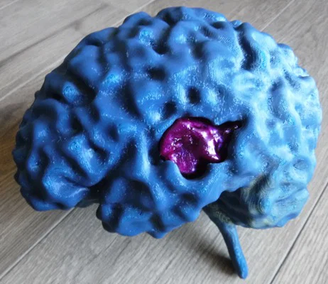 Mô hình não bộ từ dữ liệu MRI (MRI Brain) - Image 1