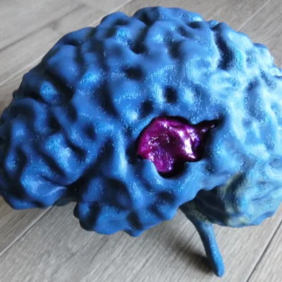 Mô hình não bộ từ dữ liệu MRI (MRI Brain)