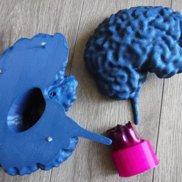 Mô hình não bộ từ dữ liệu MRI (MRI Brain)