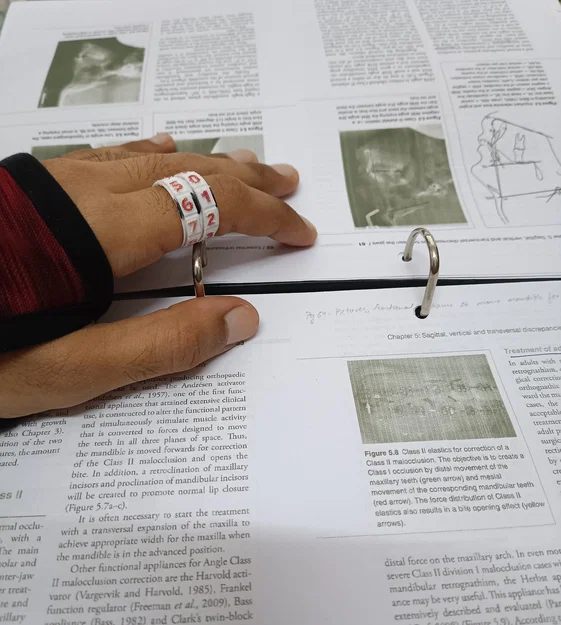 Nhẫn đếm số nhẹ nhất thế giới 1g (Chế độ Vase/Spiral) - Phụ kiện đan lát không thể thiếu! - Image 5