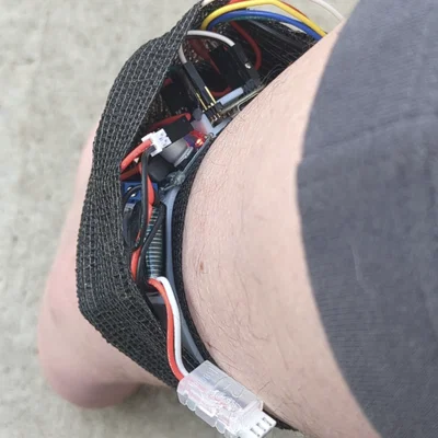 Thiết bị theo dõi dáng đi gắn cổ chân (Ankle Gait Monitors)