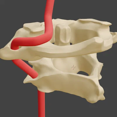 Đốt sống cổ Atlas & Axis (C1 và C2)