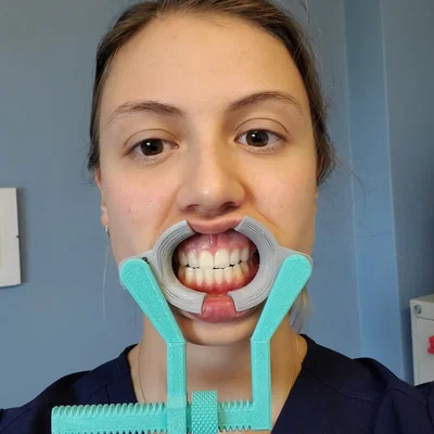 Nẹp Microstomia + Điều chỉnh