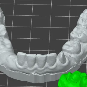 Mô hình hàm răng 3D chi tiết cho đào tạo và học tập nha khoa
