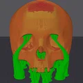 Mô hình hộp sọ người không hàm (Human Skull - Jaw Delete) in 3D - Thumbnail 2