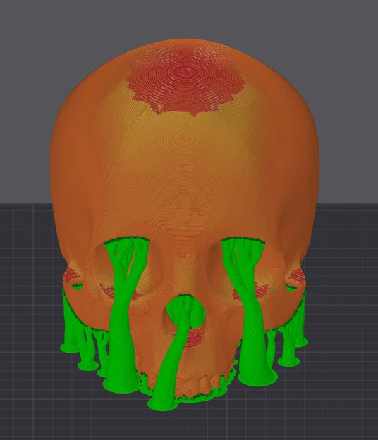 Mô hình hộp sọ người không hàm (Human Skull - Jaw Delete) in 3D - Image 3