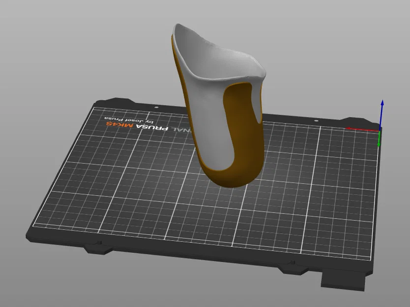Socket chân giả transfemoral (trên gối) dạng single-walled - Image 1