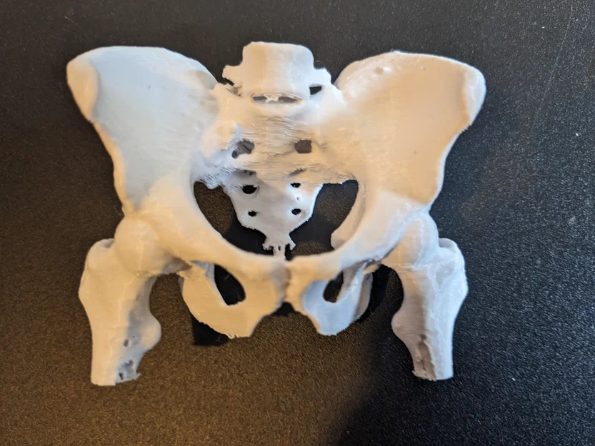 Xương chậu người thật (từ CT scan) - Image 1