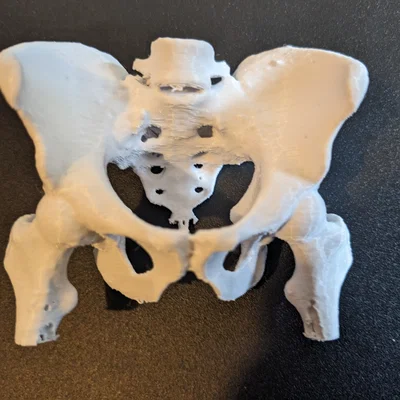 Xương chậu người thật (từ CT scan)