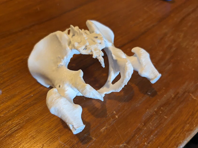 Xương chậu người thật (từ CT scan) - Image 3