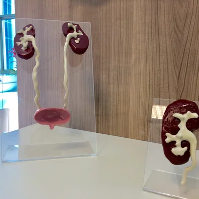 Mô hình giải phẫu hệ tiết niệu 3D chi tiết - Thận, Niệu quản, Bàng quang