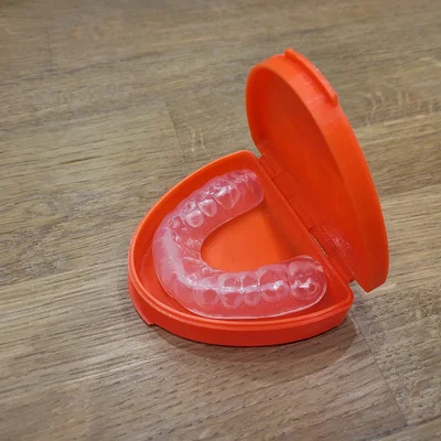 Hộp đựng bảo vệ hàm (Mouthguard Case) thiết kế nhỏ gọn in 3D