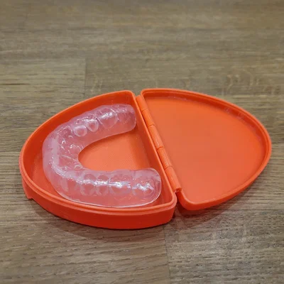 Hộp đựng bảo vệ hàm (Mouthguard Case) thiết kế nhỏ gọn in 3D