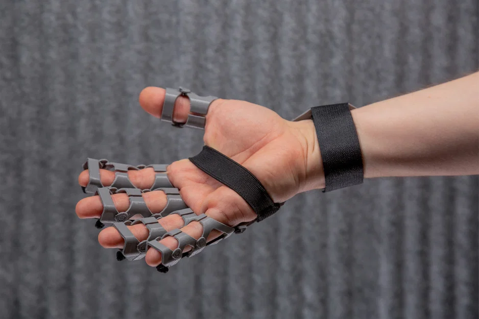 Orthosis in 3D FDM hỗ trợ phục hồi bàn tay co cứng, cải thiện vận động tinh - Image 1