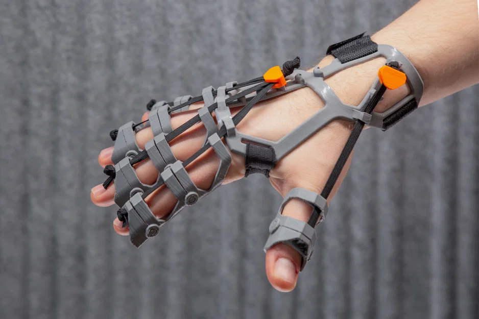 Orthosis in 3D FDM hỗ trợ phục hồi bàn tay co cứng, cải thiện vận động tinh - Image 3