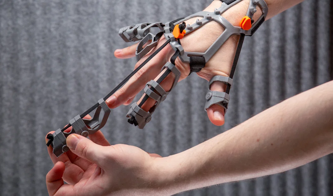 Orthosis in 3D FDM hỗ trợ phục hồi bàn tay co cứng, cải thiện vận động tinh - Image 4