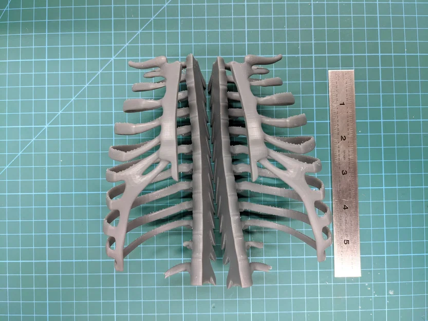 Lồng ngực sơ sinh (Neonatal Ribcage) - Image 1