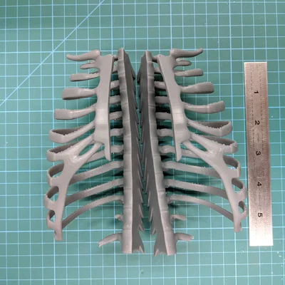 Lồng ngực sơ sinh (Neonatal Ribcage)