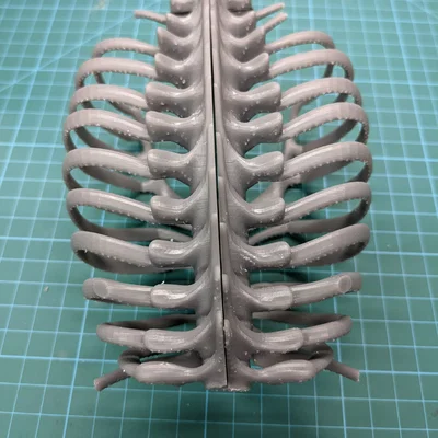 Lồng ngực sơ sinh (Neonatal Ribcage)