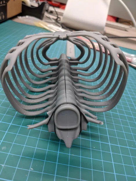 Lồng ngực sơ sinh (Neonatal Ribcage) - Image 4