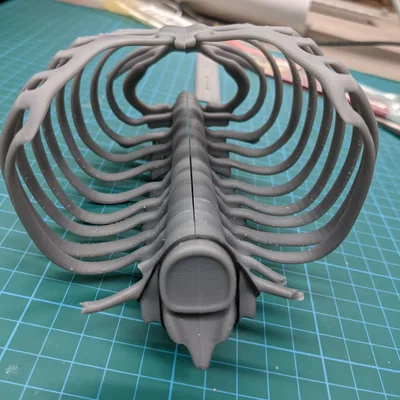 Lồng ngực sơ sinh (Neonatal Ribcage)