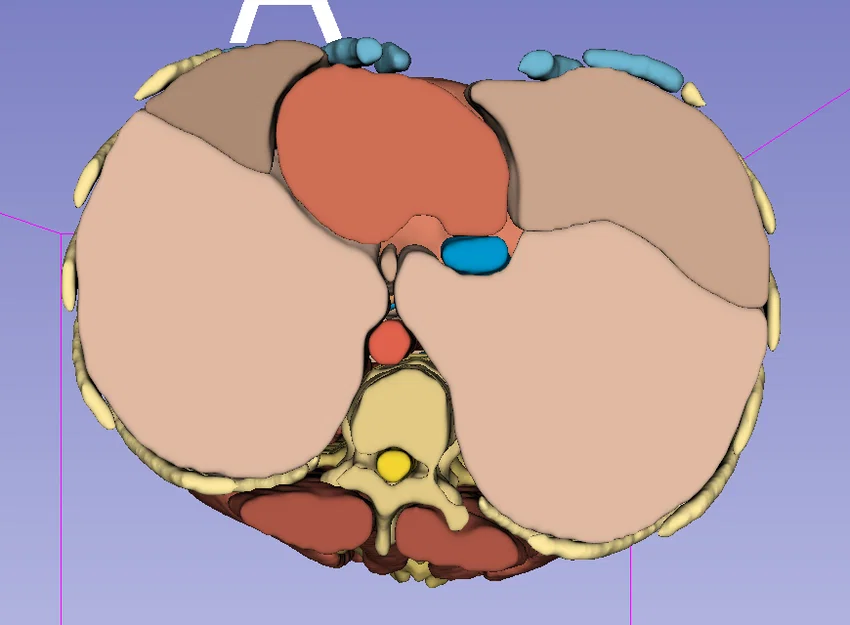 Giải phẫu người trưởng thành 2 - CT Scan - Image 3