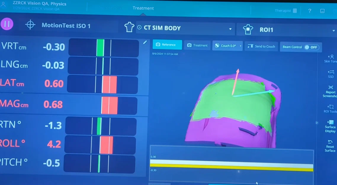 SGRT Breathing Phantom - Image 6