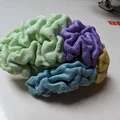 Não Bộ Tách Phần (Brain in Parts) - Thumbnail 2