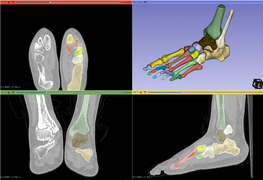 Mô hình cẳng chân linh hoạt kích thước thật phục vụ giáo dục - Image 4
