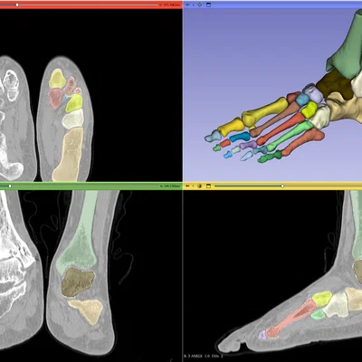 Mô hình cẳng chân linh hoạt kích thước thật phục vụ giáo dục